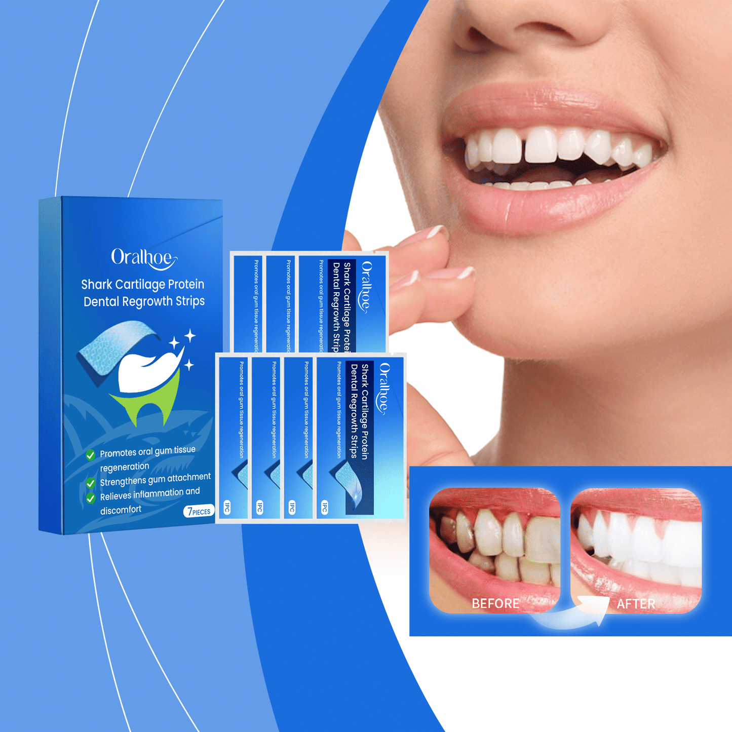 Oralhoe Dental Care And Strips For Stained Teeth